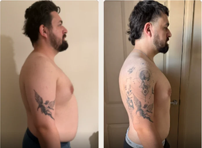 Client before and after progress photos