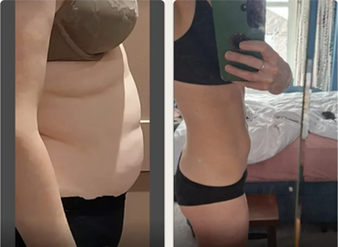 Client before and after progress photos